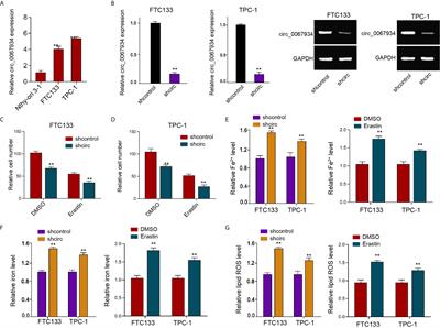 Circular RNA Circ_0067934 Attenuates Ferroptosis of Thyroid Cancer Cells by miR-545-3p/SLC7A11 Signaling